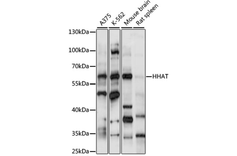 Western Blot - Anti-HHAT Antibody (A90768) - Antibodies.com