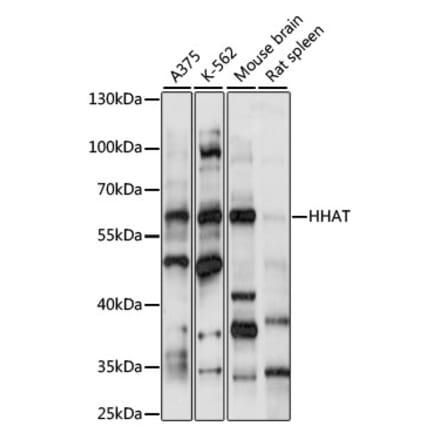 Western Blot - Anti-HHAT Antibody (A90768) - Antibodies.com