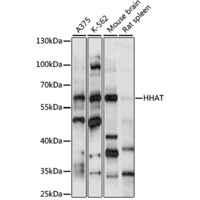 Western Blot - Anti-HHAT Antibody (A90768) - Antibodies.com