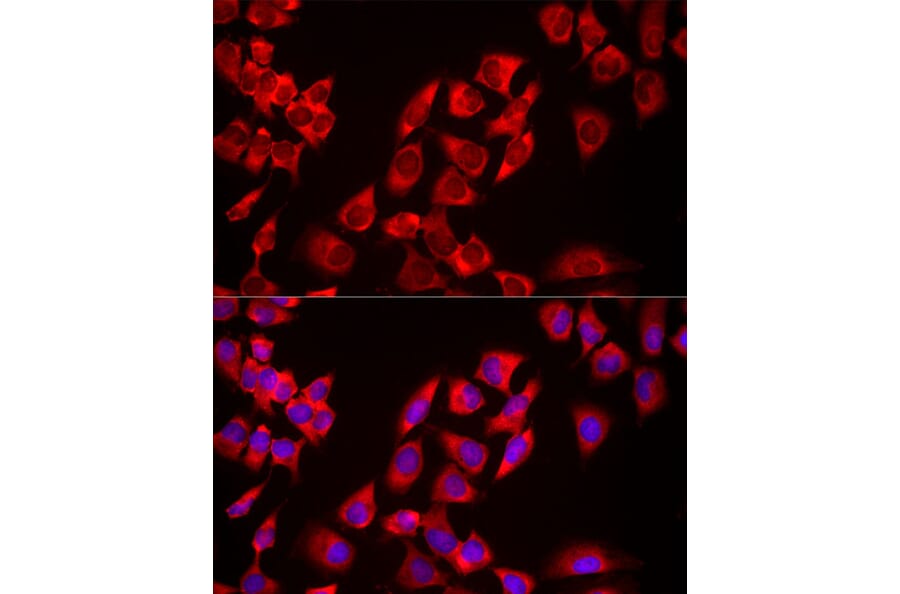 Immunofluorescence - Anti-USP21 Antibody (A90769) - Antibodies.com