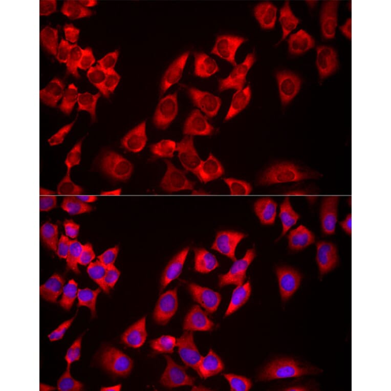 Immunofluorescence - Anti-USP21 Antibody (A90769) - Antibodies.com