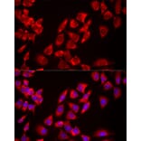 Immunofluorescence - Anti-USP21 Antibody (A90769) - Antibodies.com