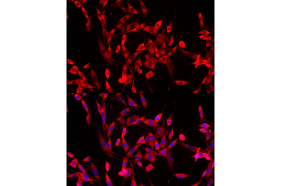 Immunofluorescence - Anti-USP21 Antibody (A90769) - Antibodies.com
