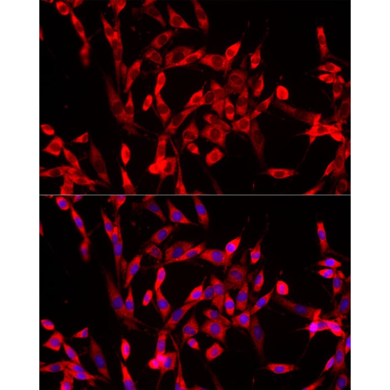 Immunofluorescence - Anti-USP21 Antibody (A90769) - Antibodies.com