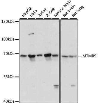 Western blot analysis of extracts of various cell lines, using Anti-MTMR9 Antibody (A13124) at 1:3000 dilution.
Secondary antibody: Goat Anti-Rabbit IgG (H+L) (HRP) (AS014) at 1:10,000 dilution.
Lysates / proteins: 25µg per lane.
Blocking buffer: 3% non-fat dry milk in TBST.
Detection: ECL Basic Kit (RM00020).
Exposure time: 10s.