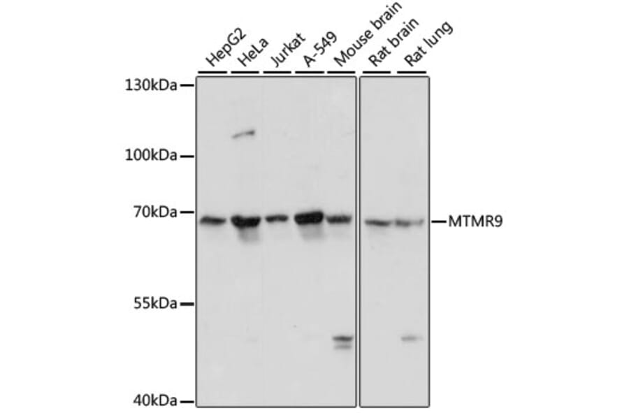 Western Blot - Anti-MTMR9 Antibody (A90770) - Antibodies.com