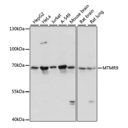 Western Blot - Anti-MTMR9 Antibody (A90770) - Antibodies.com
