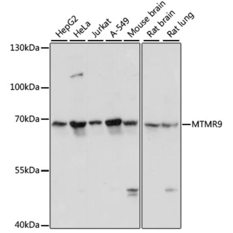 Western Blot - Anti-MTMR9 Antibody (A90770) - Antibodies.com