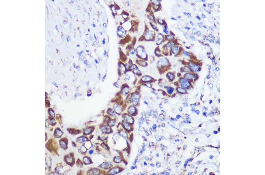 Immunohistochemistry - Anti-MTMR9 Antibody (A90770) - Antibodies.com