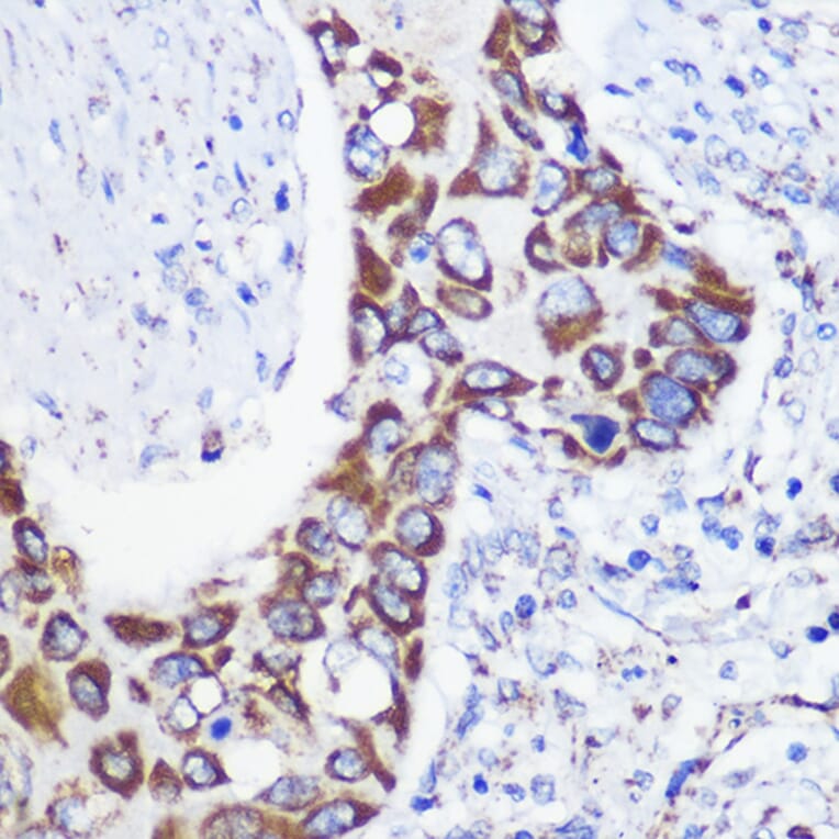 Immunohistochemistry - Anti-MTMR9 Antibody (A90770) - Antibodies.com