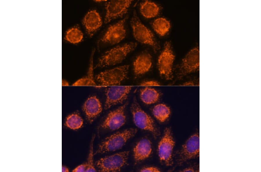 Immunofluorescence - Anti-MTMR9 Antibody (A90770) - Antibodies.com