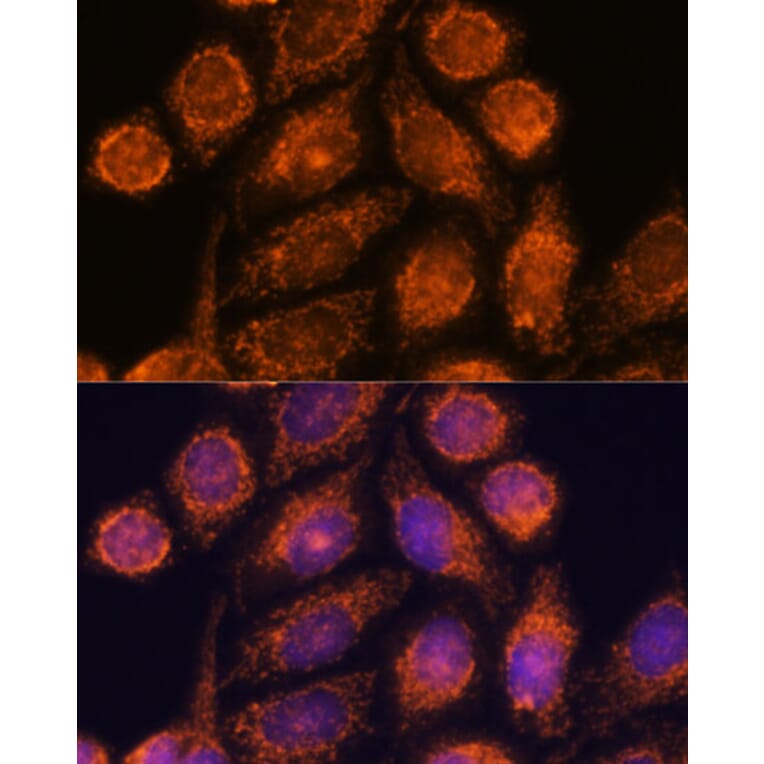 Immunofluorescence - Anti-MTMR9 Antibody (A90770) - Antibodies.com