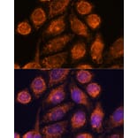 Immunofluorescence - Anti-MTMR9 Antibody (A90770) - Antibodies.com