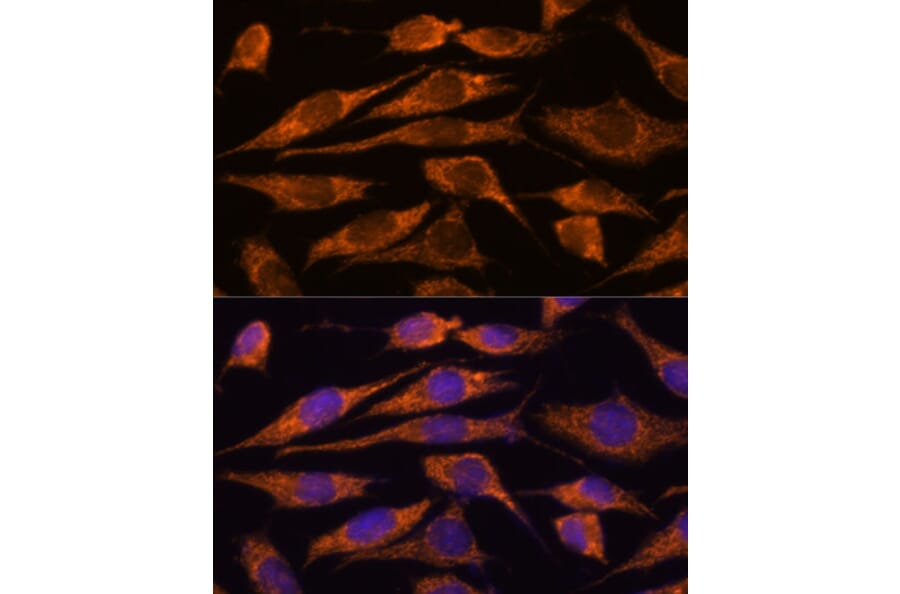 Immunofluorescence - Anti-MTMR9 Antibody (A90770) - Antibodies.com