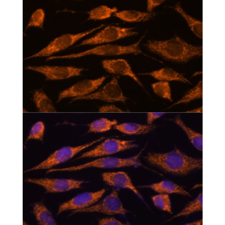 Immunofluorescence - Anti-MTMR9 Antibody (A90770) - Antibodies.com
