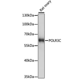 Western Blot - Anti-RPC62 Antibody (A90771) - Antibodies.com