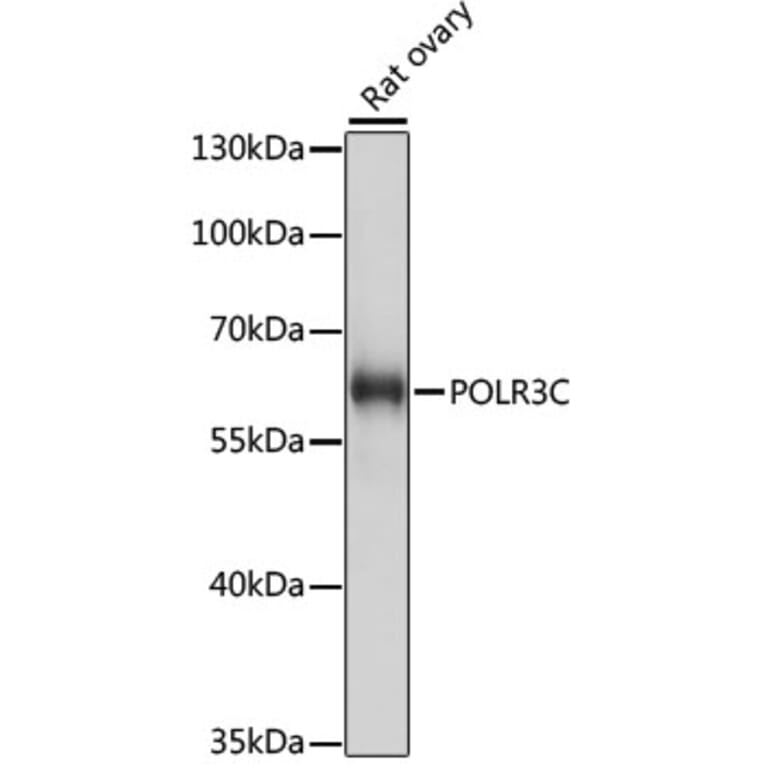 Western Blot - Anti-RPC62 Antibody (A90771) - Antibodies.com