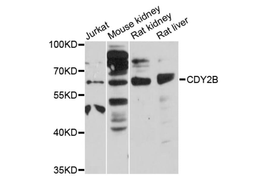 Western Blot - Anti-CDY2B Antibody (A12662) - Antibodies.com