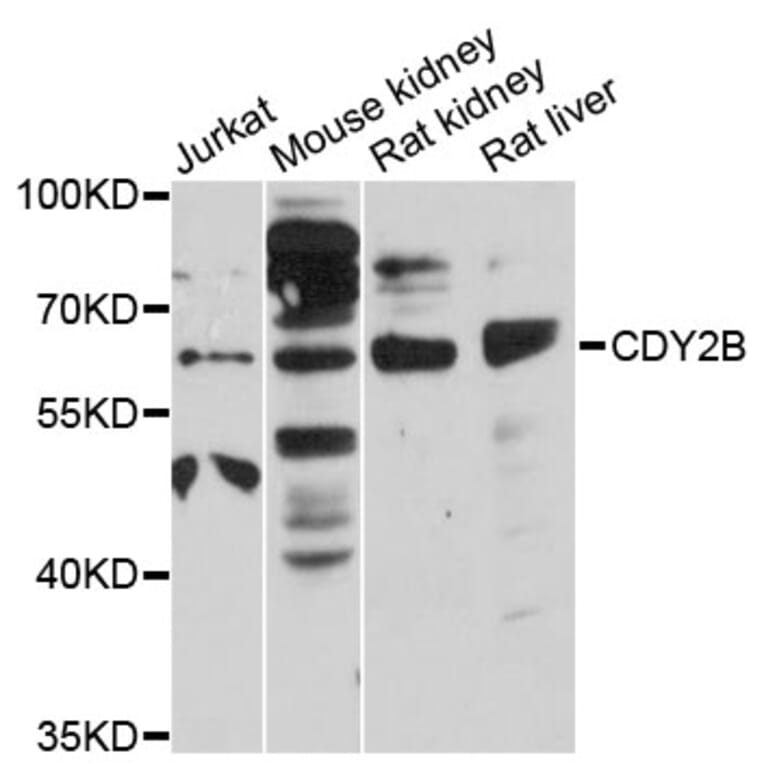 Western Blot - Anti-CDY2B Antibody (A12662) - Antibodies.com