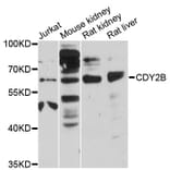 Western Blot - Anti-CDY2B Antibody (A12662) - Antibodies.com