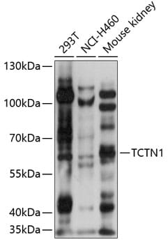 Western blot analysis of extracts of various cell lines, using Anti-TCTN1 Antibody (A14929) at 1:1,000 dilution.
Secondary antibody: Goat Anti-Rabbit IgG (H+L) (HRP) (AS014) at 1:10,000 dilution.
Lysates / proteins: 25µg per lane.
Blocking buffer: 3% non-fat dry milk in TBST.
Detection: ECL Basic Kit (RM00020).
Exposure time: 5s.