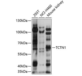 Western Blot - Anti-TCTN1 Antibody (A90774) - Antibodies.com