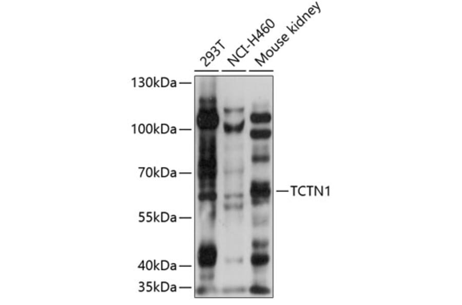 Western Blot - Anti-TCTN1 Antibody (A90774) - Antibodies.com