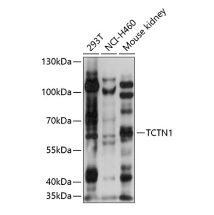Western Blot - Anti-TCTN1 Antibody (A90774) - Antibodies.com
