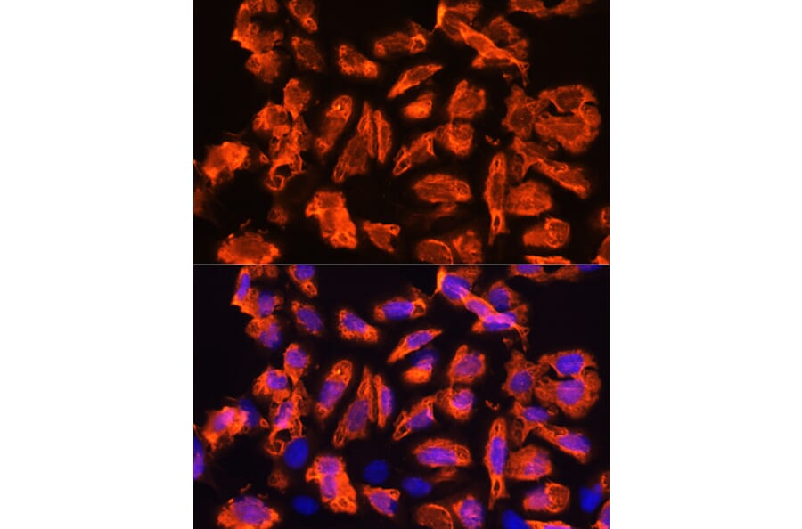 Immunofluorescence - Anti-TCTN1 Antibody (A90774) - Antibodies.com