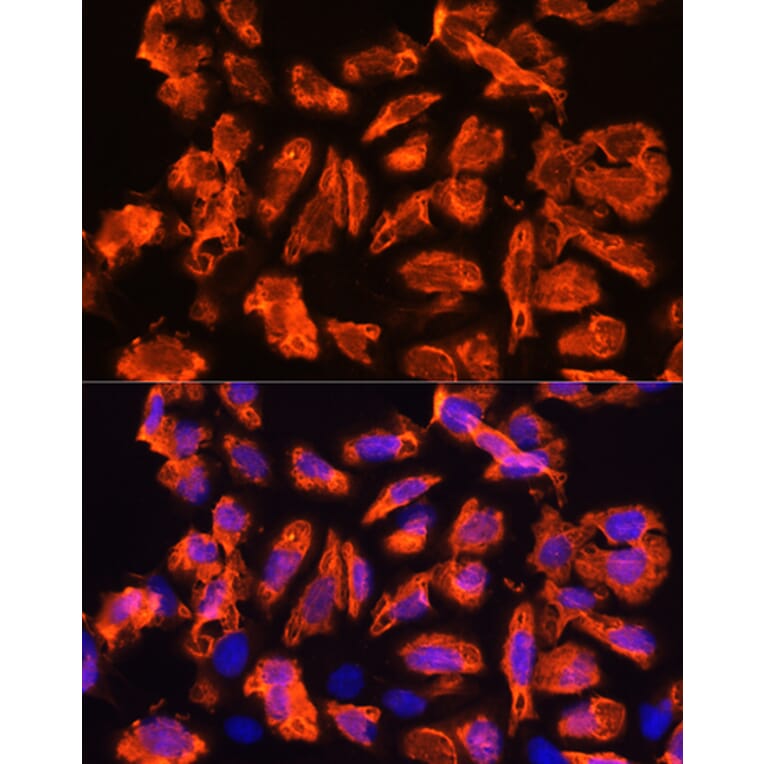 Immunofluorescence - Anti-TCTN1 Antibody (A90774) - Antibodies.com