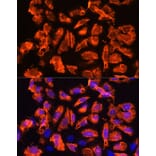 Immunofluorescence - Anti-TCTN1 Antibody (A90774) - Antibodies.com