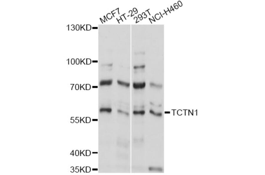 Western Blot - Anti-TCTN1 Antibody (A14928) - Antibodies.com