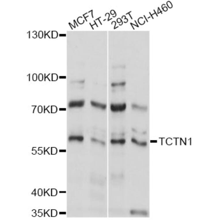 Western Blot - Anti-TCTN1 Antibody (A14928) - Antibodies.com