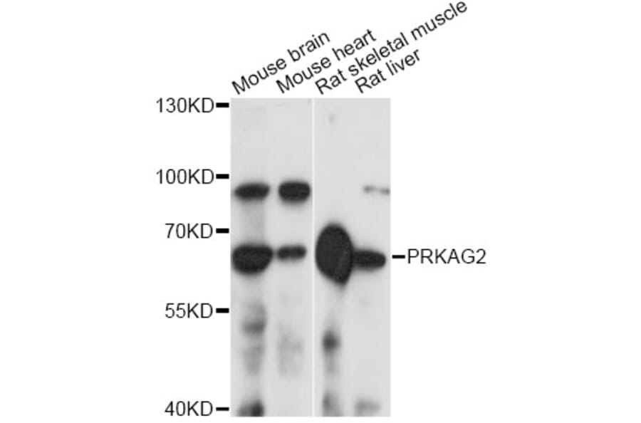 Western Blot - Anti-PRKAG2 Antibody (A14280) - Antibodies.com