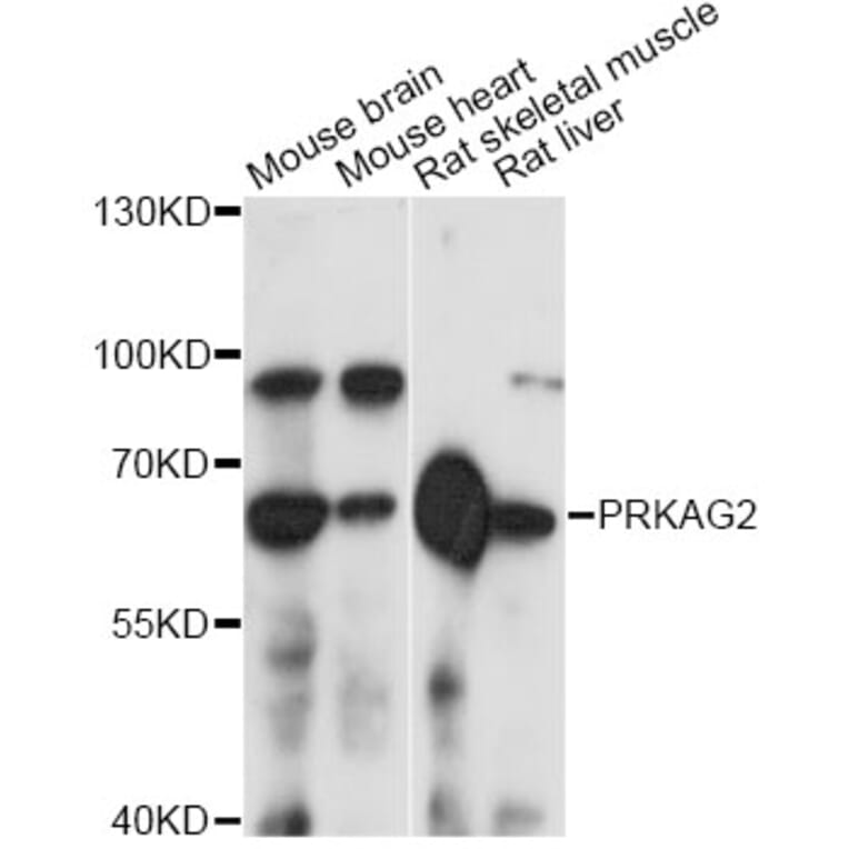 Western Blot - Anti-PRKAG2 Antibody (A14280) - Antibodies.com