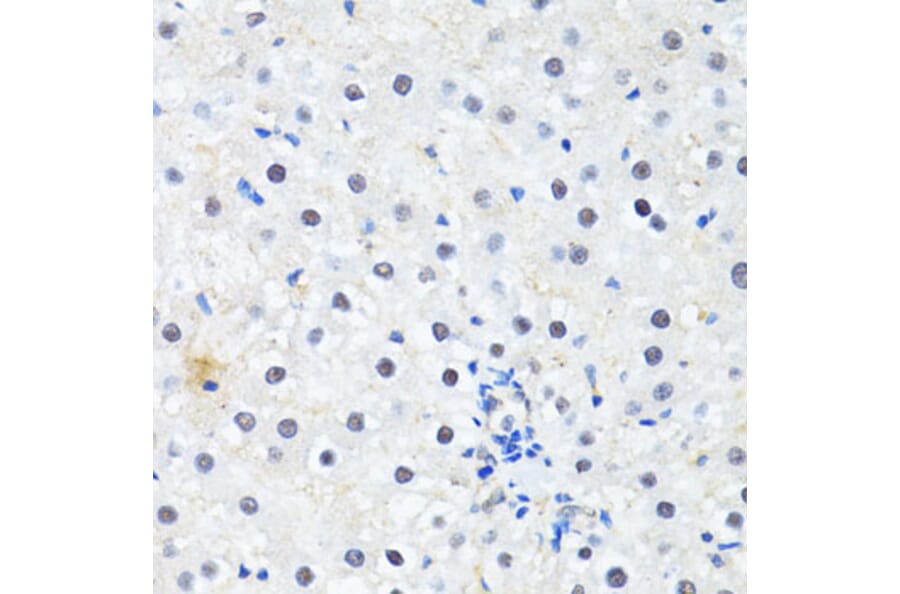 Immunohistochemistry - Anti-PRKAG2 Antibody (A14280) - Antibodies.com