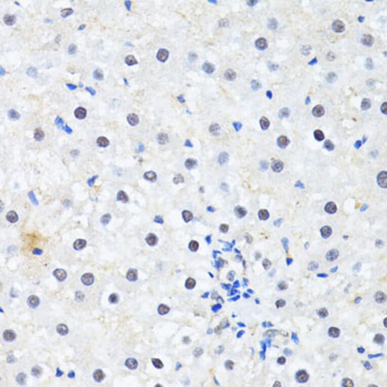 Immunohistochemistry - Anti-PRKAG2 Antibody (A14280) - Antibodies.com