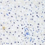 Immunohistochemistry - Anti-PRKAG2 Antibody (A14280) - Antibodies.com