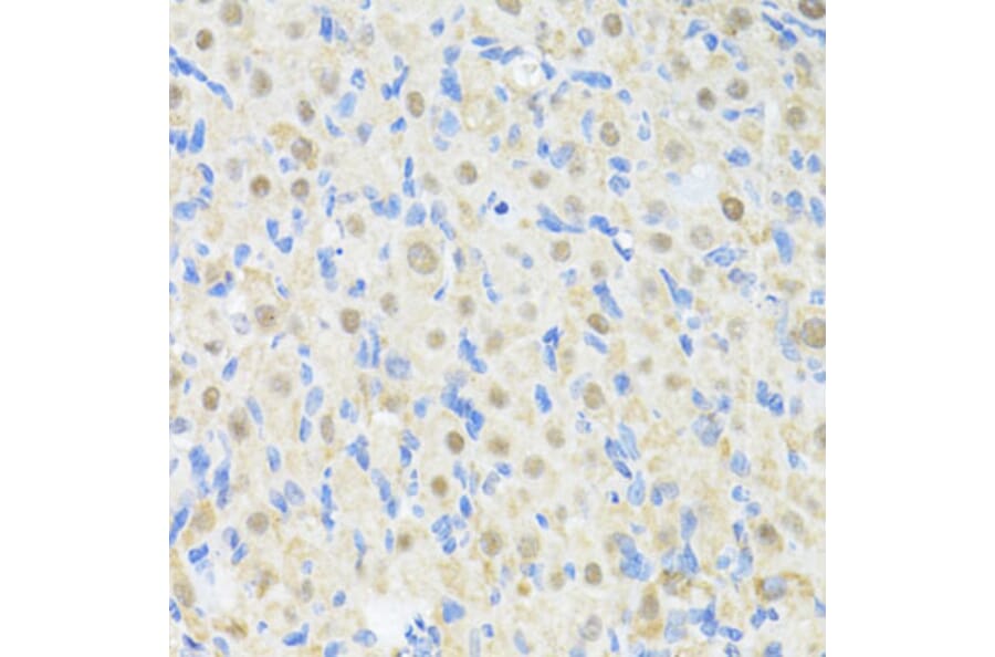 Immunohistochemistry - Anti-PRKAG2 Antibody (A14280) - Antibodies.com