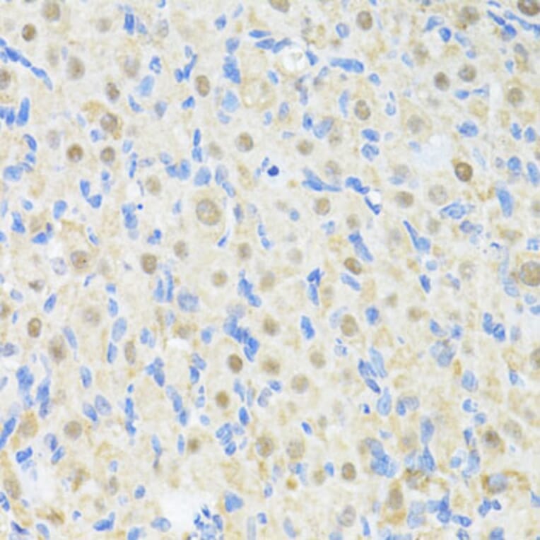 Immunohistochemistry - Anti-PRKAG2 Antibody (A14280) - Antibodies.com