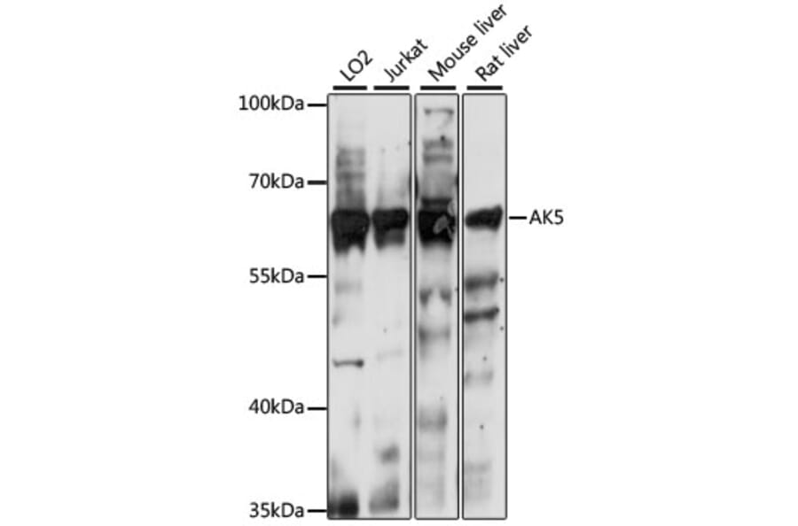 Western Blot - Anti-AK5 Antibody (A90777) - Antibodies.com