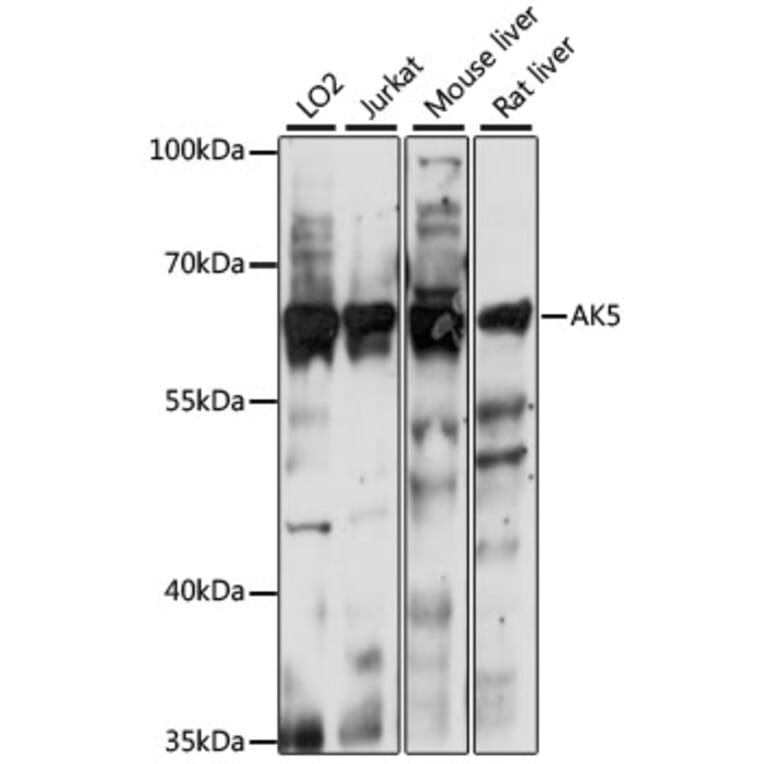 Western Blot - Anti-AK5 Antibody (A90777) - Antibodies.com