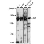 Western Blot - Anti-AK5 Antibody (A90777) - Antibodies.com