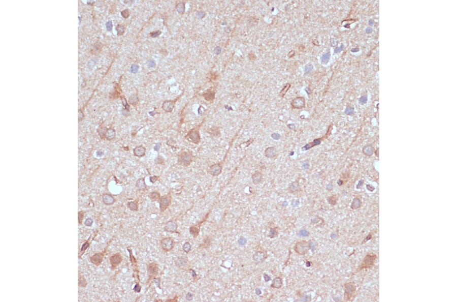 Immunohistochemistry - Anti-AK5 Antibody (A90777) - Antibodies.com