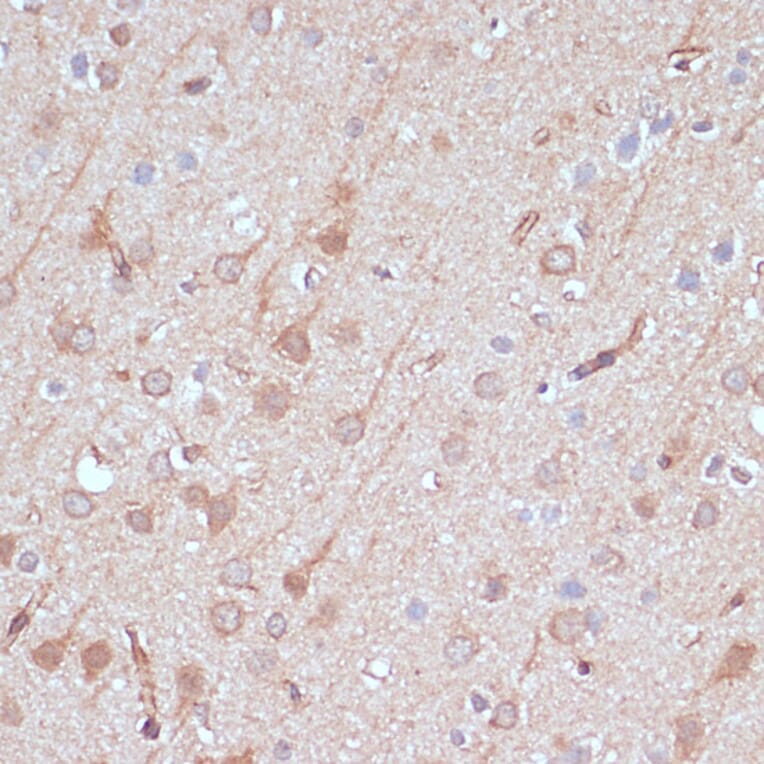 Immunohistochemistry - Anti-AK5 Antibody (A90777) - Antibodies.com