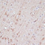 Immunohistochemistry - Anti-AK5 Antibody (A90777) - Antibodies.com