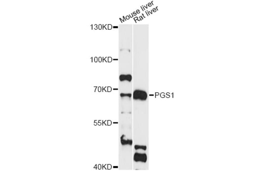 Western Blot - Anti-PGS1 Antibody (A14308) - Antibodies.com