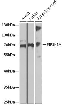 Western blot analysis of extracts of various cell lines, using Anti-PIP5K1A Antibody (A13374) at 1:1,000 dilution.
Secondary antibody: Goat Anti-Rabbit IgG (H+L) (HRP) (AS014) at 1:10,000 dilution.
Lysates / proteins: 25µg per lane.
Blocking buffer: 3% non-fat dry milk in TBST.
Detection: ECL Basic Kit (RM00020).
Exposure time: 90s.