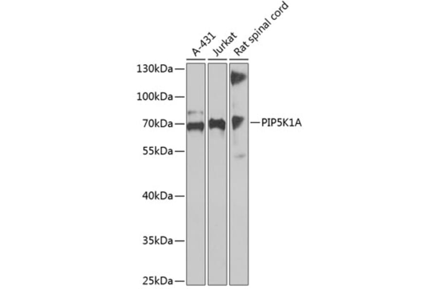 Western Blot - Anti-PIP5K1 alpha / PIP5K1A Antibody (A90780) - Antibodies.com
