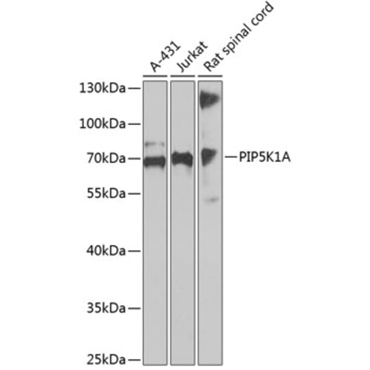 Western Blot - Anti-PIP5K1 alpha / PIP5K1A Antibody (A90780) - Antibodies.com